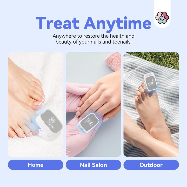 Saviland nail fungus laser treatment device - treat anytime